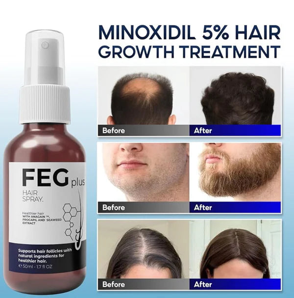 FEG PLUS Hair Growth SprayFEG PLUS Hair Growth Spray