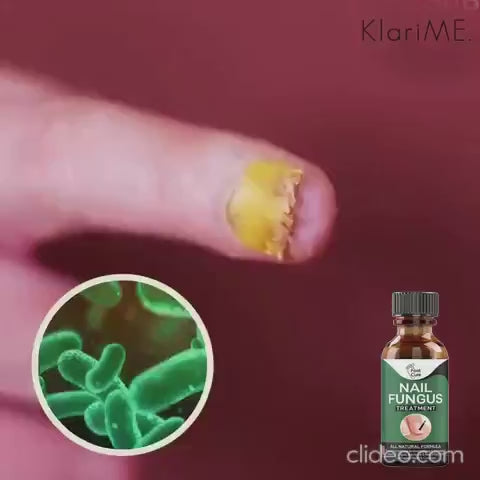 •Fast Nail Fungal Treatments Nail Repair
•  Quickly Penetrates And Kills